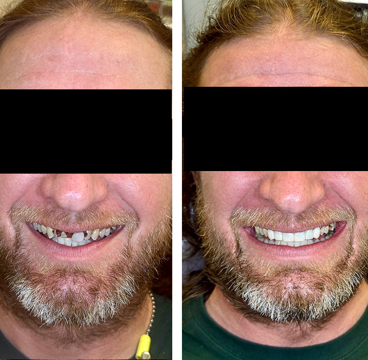 Smile Makeovers Princeton, TX 75407