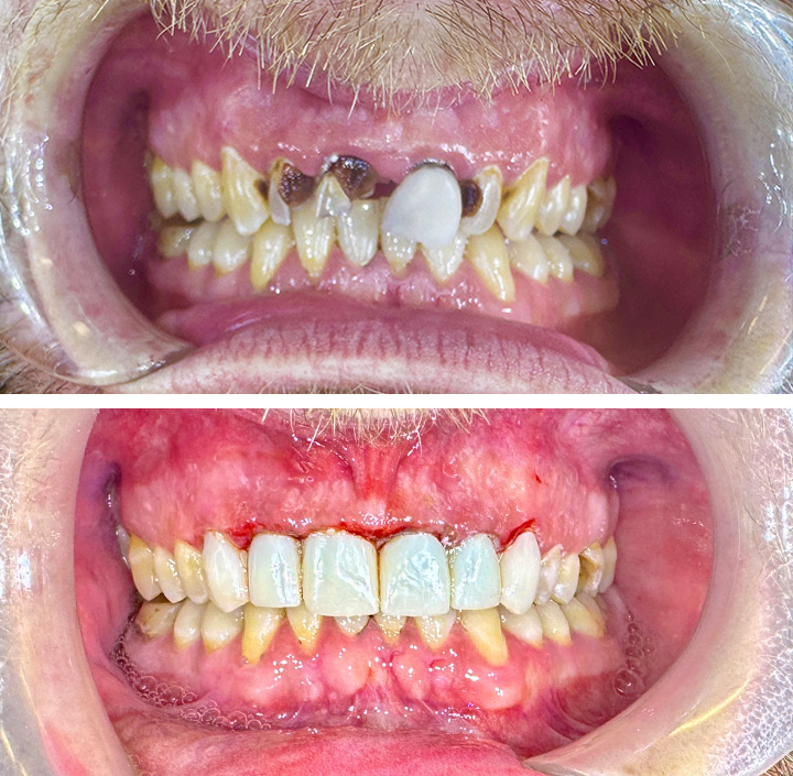 Smile Makeovers Princeton, TX 75407