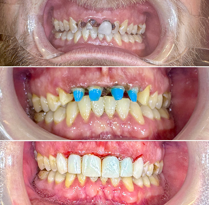 Smile Makeovers Princeton, TX 75407