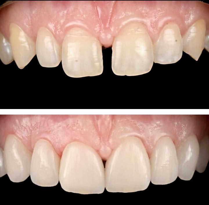 Smile Makeovers Princeton, TX 75407