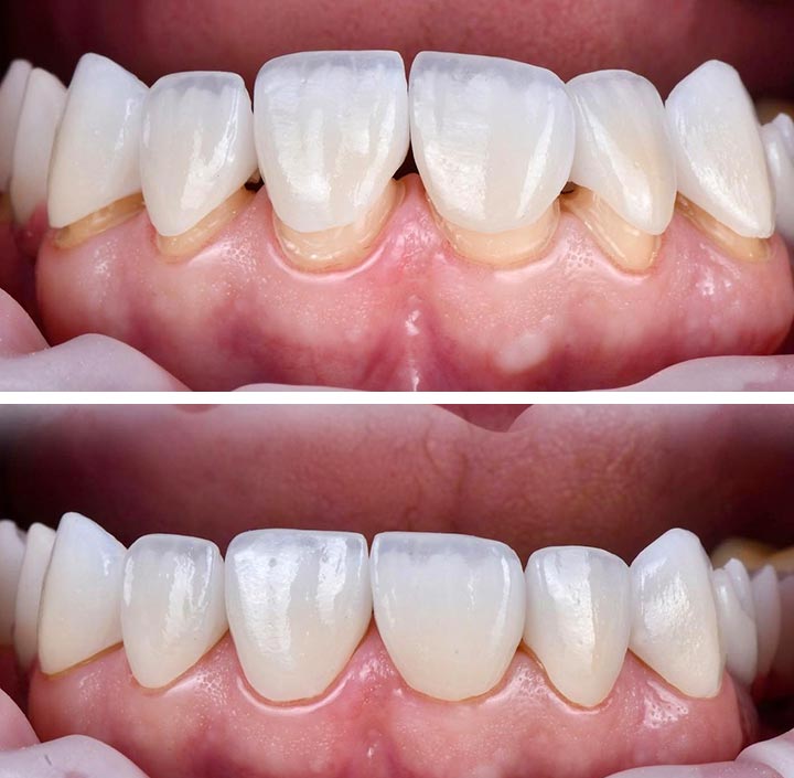 Smile Makeovers Princeton, TX 75407