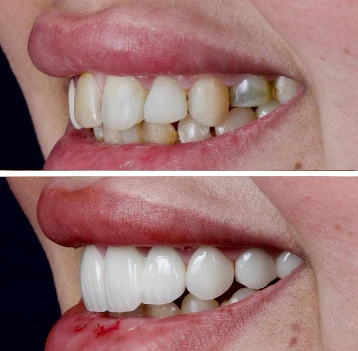 Smile Makeovers Princeton, TX 75407
