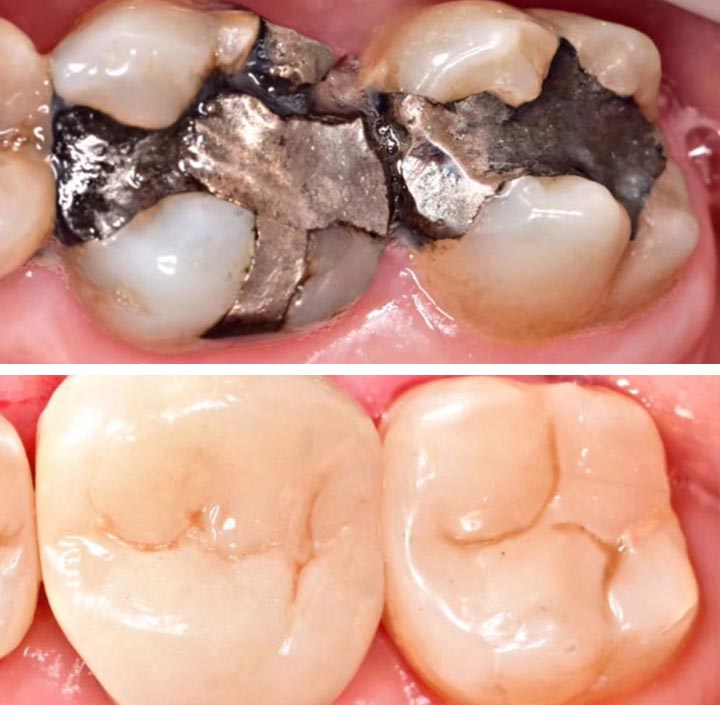 Smile Makeovers Princeton, TX 75407