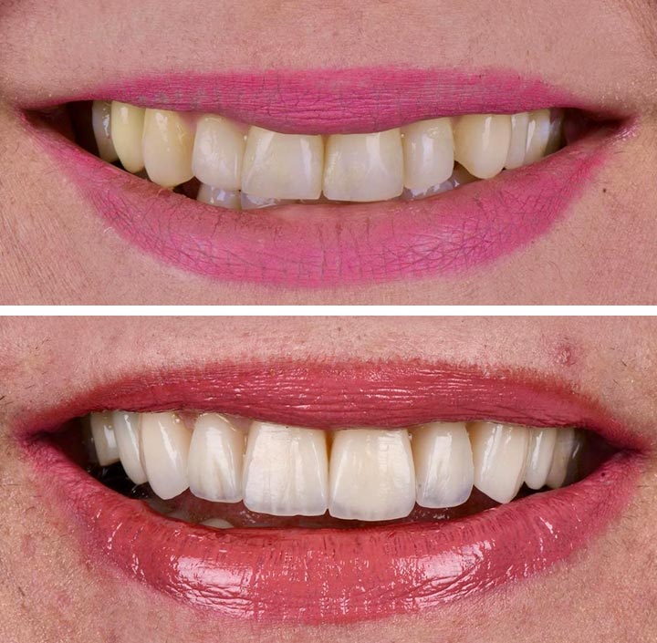 Smile Makeovers Princeton, TX 75407