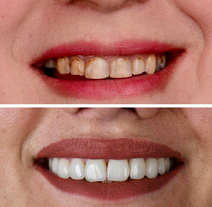 Smile Makeovers Princeton, TX 75407