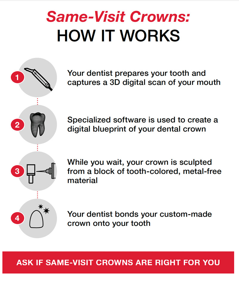 Same Day Dental Crowns Princeton